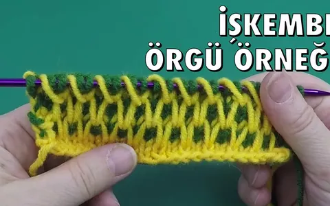 İşkembe #2